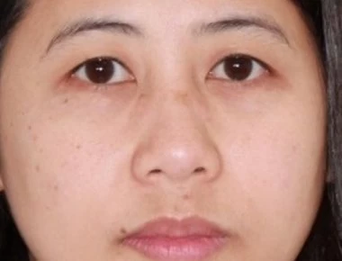 Εξαφανίστηκε Φιλιππινέζα στην Κύπρο - Πανικός λόγω του serial killer